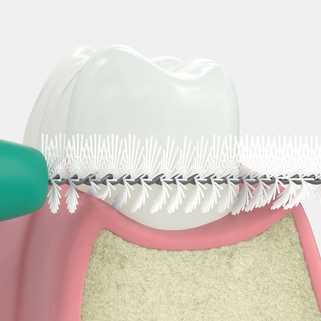 solo-med_2001-2012_interdental-normal-seitenansicht.webp