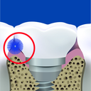 solo-med_2404-2409_zaehne-mit-solo-stix-i-03.webp