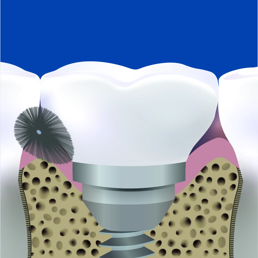 solo-med_2404-2409_zaehne-mit-solo-stix-i-04.webp