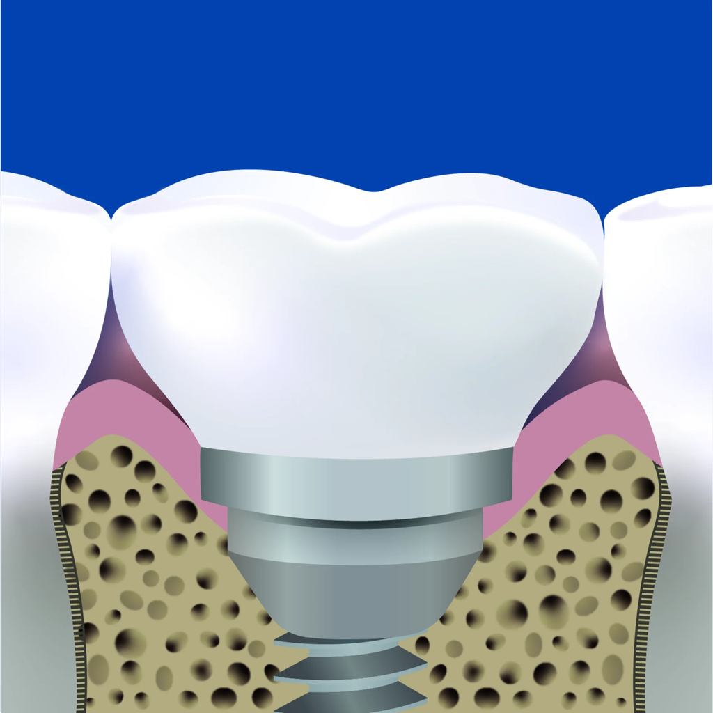 solo-med_2404-2409_zaehne-mit-solo-stix-i-02.webp