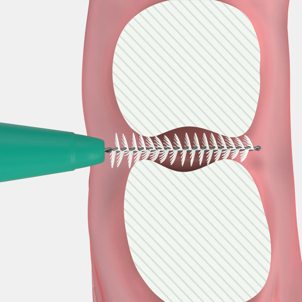 solo-med_2001-2012_interdental-normal-draufsicht.webp