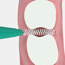 solo-med_2001-2012_interdental-normal-draufsicht.webp